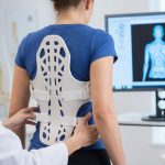 Medikal 3D Baskı Neden Kişiye Özel Ortezlerde Öne Çıkıyor? ScolioLife’ın Yeni Entegrasyonu