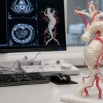 Pulmoner Damar Müdahalesinde 3D Baskılı Modeller: UPMC ve UCSF’den Planlama Örneği